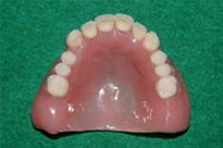 CompleteDenture